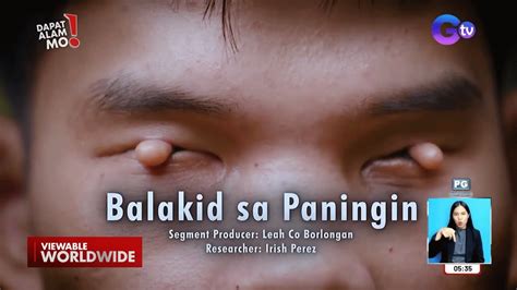 kuntil sa pwet|Nangagating Pwet: Mga Dahilan Nito .
